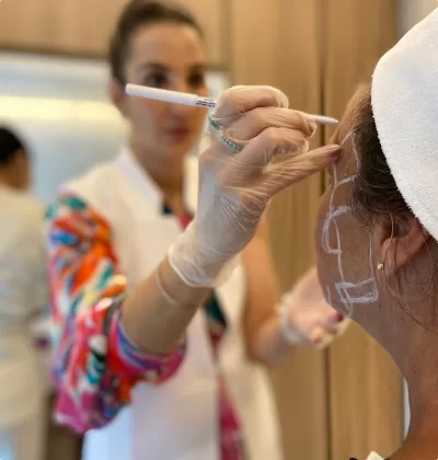 Preenchimento Facial com Ácido Hialurônico (MDcodes)